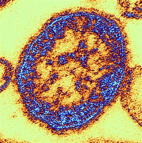 measles virus